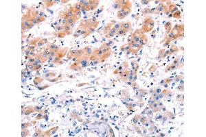 Immunohistochemistry (IHC) image for anti-C-Type Lectin Domain Family 4, Member D (CLEC4D) (AA 39-215) antibody (ABIN3016483) (CLEC4D Antikörper  (AA 39-215))