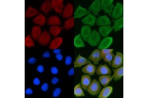 ABIN6257057 and ABIN6274550 staining Hela cells(45 min of heat-shock) by IF/ICC. (CHKB Antikörper  (C-Term))