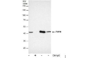 IP Image Immunoprecipitation of TUFM protein from HepG2 whole cell extracts using 5 μg of TUFM antibody , or TUFM antibody, Western blot analysis was performed using TUFM antibody, EasyBlot anti-Rabbit IgG  was used as a secondary reagent. (TUFM Antikörper)