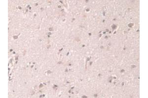 Figure. (Grancalcin Antikörper  (AA 1-139))