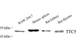 Western blot analysis of TTC5 (ABIN7075874),at dilution of 1: 1000,Lane 1: RAW 264. (TTC5 Antikörper)