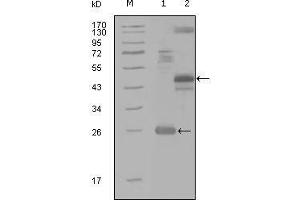 Western blot analysis using MAP4K4 mouse mAb against truncated Trx-MAP4K4 recombinant protein (1), MBP-MAP4K4 (aa300-400) recombinant protein (2) and MAP4K4(aa194-436)-hIgGFc transfected CH0-K1 cell lysate(3).