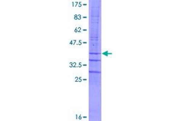 C4orf6 Protein (AA 1-93) (GST tag)