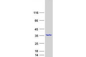 Validation with Western Blot