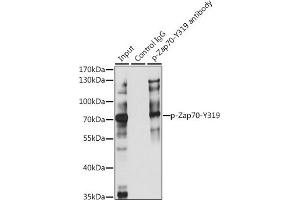 Immunoprecipitation analysis of 200 μg extracts of Jurkat cells, using 3 μg Phospho-Z-Y319 pAb (ABIN3023645, ABIN3023646, ABIN3023647, ABIN1682143 and ABIN1682144).