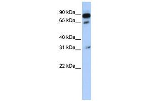 WB Suggested Anti-ABCD4 Antibody Titration:  0. (ABCD4 Antikörper  (N-Term))