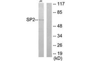 Western blot analysis of extracts from Jurkat cells, using SP2 Antibody.