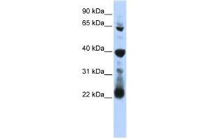 WB Suggested Anti-RPUSD3 Antibody Titration:  0. (RPUSD3 Antikörper  (Middle Region))