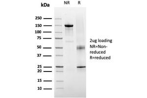 SDS-PAGE Analysis Purified TIGIT-Monospecific Mouse Monoclonal Antibody (TIGIT/3106). (TIGIT Antikörper  (AA 22-141))