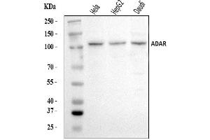 Western blot analysis of ADAR1/ADAR using anti-ADAR1/ADAR antibody (ABIN7598956).
