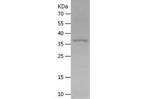 CYP7B1 Protein (AA 39-180) (His-IF2DI Tag)