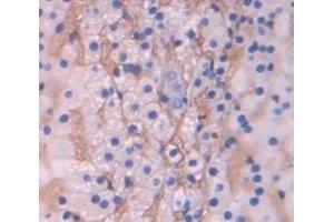 IHC-P analysis of Kidney tissue, with DAB staining. (SCARB1 Antikörper  (AA 33-440))