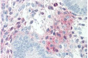 Immunohistochemistry (Paraffin-embedded Sections) (IHC (p)) image for anti-serpin Peptidase Inhibitor, Clade F (Alpha-2 Antiplasmin, Pigment Epithelium Derived Factor), Member 1 (SERPINF1) (AA 196-347) antibody (ABIN337197)