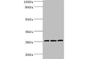 Western blot All lanes: Claudin-14 antibody at 4 μg/mL Lane 1: Rat liver tissue Lane 2: Mouse kidney tissue Lane 3: Hela whole cell lysate Secondary Goat polyclonal to rabbit IgG at 1/10000 dilution Predicted band size: 26 kDa Observed band size: 26 kDa (CLDN14 Antikörper  (AA 140-239))