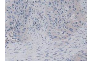 Figure. (CD94 Antikörper  (AA 32-179))
