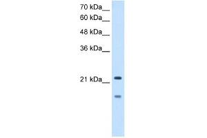 MMP7 antibody used at 2. (MMP7 Antikörper)
