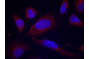 Immunofluorescence (IF) image for anti-Nitric Oxide Synthase 3 (Endothelial Cell) (NOS3) (pSer1177) antibody (ABIN1870485) (ENOS Antikörper  (pSer1177))