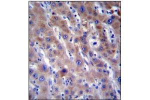 Immunohistochemistry analysis in Formalin Fixed, Paraffin Embedded Human liver tissue stained with FADS2 Antibody (N-term) followed by peroxidase conjugation of the secondary antibody and DAB staining. (FADS2 Antikörper  (N-Term))