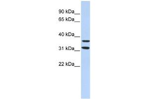 WB Suggested Anti-ZNF254 Antibody Titration:  0. (ZNF254 Antikörper  (Middle Region))