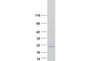Western Blotting (WB) image for Phosphatidylinositol Glycan H (PIGH) protein (Myc-DYKDDDDK Tag) (ABIN2728888)