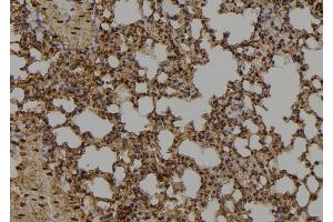 ABIN6274019 at 1/100 staining Mouse lung tissue by IHC-P.