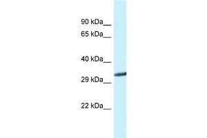 WB Suggested Anti-Gnmt Antibody   Titration: 1.