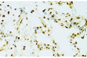 Immunohistochemistry of paraffin-embedded Rat lung using RCC1 Polyclonal Antibody at dilution of 1:100 (40x lens). (RCC1 Antikörper)