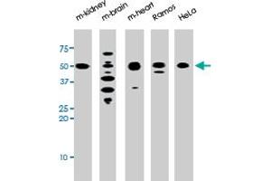 The park polyclonal antibody  is used in Western blot to detect park in, from left to right, mouse kidney, mouse brain, mouse heart, Ramos, and HeLa tissue lysates . (Parkin Antikörper  (N-Term))