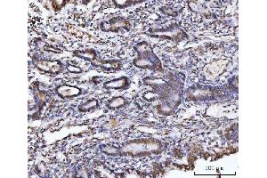 IHC analysis of UBA6 using anti-UBA6 antibody (ABIN7602559). (UBA6 Antikörper  (AA 85-1033))