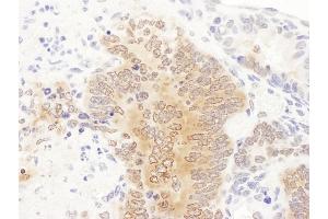 Immunohistochemistry (IHC) image for anti-Phosphoribosylglycinamide Formyltransferase (GART) (AA 200-250) antibody (ABIN7455020) (GART Antikörper  (AA 200-250))
