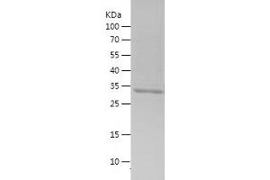 Western Blotting (WB) image for Ubiquitin A-52 Residue Ribosomal Protein Fusion Product 1 (UBA52) (AA 1-90) protein (His-IF2DI Tag) (ABIN7125576)