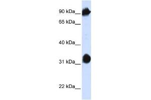 HSPA4 antibody used at 1 ug/ml to detect target protein. (HSPA4 Antikörper  (N-Term))