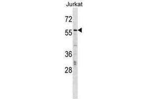 CBFA2T2 Antibody (N-term) western blot analysis in Jurkat cell line lysates (35µg/lane).
