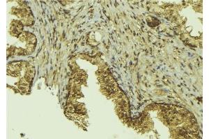 ABIN6276536 at 1/100 staining Mouse colon tissue by IHC-P. (CTCF Antikörper  (C-Term))