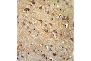Formalin fixed, paraffin embedded brain tissue stained with RGR Antibody  followed by peroxidase conjugation of the secondary antibody and DAB staining. (RGR Antikörper  (Middle Region))