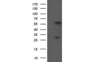 Image no. 1 for anti-Chaperonin Containing TCP1, Subunit 8 (Theta)-Like 2 (CCT8L2) antibody (ABIN1497483)