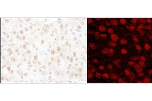 Immunohistochemistry (IHC) image for anti-Poly (ADP-Ribose) Polymerase 1 (PARP1) (AA 50-100) antibody (ABIN7455230)