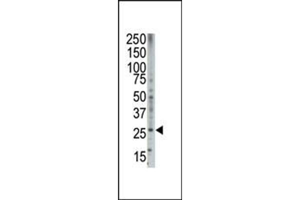 BOK Antikörper  (AA 60-90)