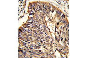 Immunohistochemistry (IHC) image for anti-Myeloid Differentiation Primary Response Gene (88) (MYD88) antibody (ABIN2915923)