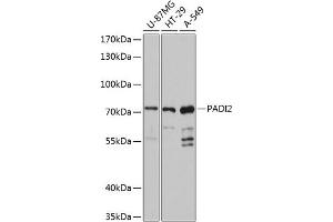 Western blot analysis of extracts of various cell lines, using P antibody (ABIN6128411, ABIN6145164, ABIN6145166 and ABIN6215841) at 1:3000 dilution. (PADI2 Antikörper  (AA 1-200))