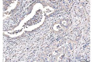 IHC analysis of CD163 using anti-CD163 antibody (ABIN5693082). (CD163 Antikörper  (AA 47-201))