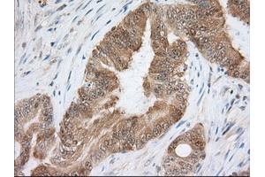 Immunohistochemical staining of paraffin-embedded Human liver tissue using anti-ACAT2 mouse monoclonal antibody. (ACAT2 Antikörper)