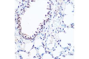 Immunohistochemistry of paraffin-embedded mouse lung using S Rabbit pAb (ABIN6128698, ABIN6147392, ABIN6147393 and ABIN6215703) at dilution of 1:100 (40x lens). (SART3 Antikörper  (AA 664-963))