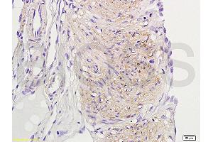 Formalin-fixed and paraffin embedded rat uterine myoma labeled with Rabbit Anti-ER-beta Polyclonal Antibody (ABIN725735) at 1:200 followed by conjugation to the secondary antibody and DAB staining. (TACR3 Antikörper  (AA 151-250))