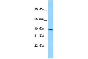 WB Suggested Anti-DMKN Antibody Titration: 1. (Dermokine Antikörper  (C-Term))