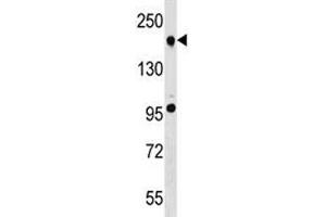 TET2 antibody western blot analysis in A549 lysate. (TET2 Antikörper  (AA 528-554))