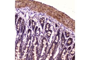 IHC testing of FFPE rat small intestine with p65 antibody at 2ug/ml.