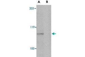 Western blot analysis of GP6 in mouse brain lysate with GP6 polyclonal antibody  at 1 ug/mL in either the absence or (B) the presence of blocking peptide.