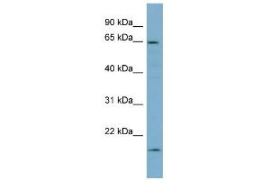 WB Suggested Anti-PLS3 Antibody Titration: 0. (Plastin 3 Antikörper  (Middle Region))