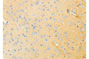 ABIN6264577 and ABIN6273305 at 1/100 staining Mouse brain tissue by IHC-P. (RAB3A Antikörper  (N-Term))